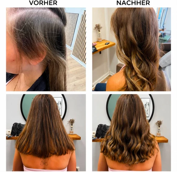 Vorher Nachher Haarverdichtung Viersen: Natürliche Fülle